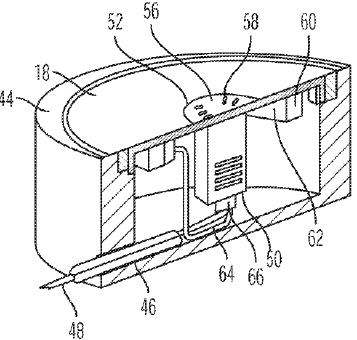 patent